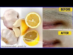 Remove unwanted hair forever fast with lemon home remedy / Facial hair removal in one day