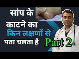 सांप के काटने पर क्या लक्षणों से पता चलता है symptoms after snake bite Part2