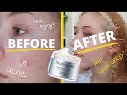 Neutrogena Rapid Wrinkle Repair Review!! *not sponsored* // Retinol for Acne // 3 month progress!