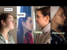 Gua sha Amazing Results Before and After Tiktok Compilation (SHOCKING)