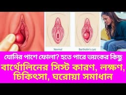 যোনির পাশে ফোলা? হতে পারে বার্থোলিন সিস্ট! ভয় না পেয়ে করণীয় কী? বার্থোলিনের সিস্ট কী? এর কারণ কী?