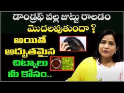 డాండ్రఫ్ వల్ల జుట్టు రాలడం మొదలవుతుందా? | Dr Sudha Vani about Hair Problem and Solution | Leo Health