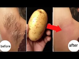 stop shaving! here s how to permanently get rid of facial, body and pubic hair