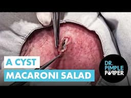 A Cyst Macaroni Salad Compilation