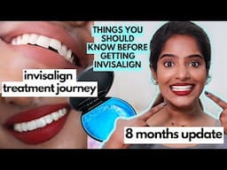 Invisalign Journey Update🤫Things to know before Getting Invisalign🦷Cost,Duration,Pain Update👌🏾