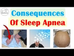 Consequences of Sleep Apnea | Cognitive Dysfunction, Depression, Heart Disease & More