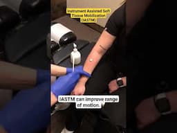 Arm SCRAPING Pain Relief IASTM Graston #chiropractic #paintreatment  #painrelief