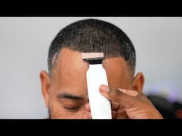 This was the ONLY Way to Save unc HAIRLINE!