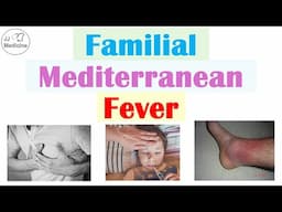 Familial Mediterranean Fever | Pathophysiology, Symptoms, Diagnosis, Treatment