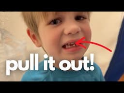 Mild Autism with Loose Tooth | Will the Tooth Fairy Come?