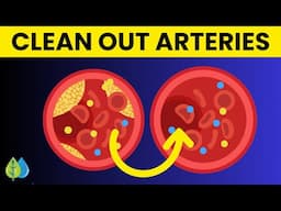 The Best CHECKLIST to Clean Out Your Arteries