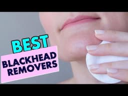 Best Blackhead Removers: Tools, Treatments, & Home Remedies