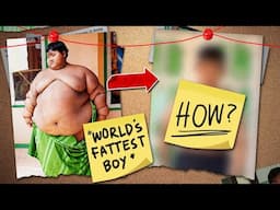 Insane Weight Loss of World's Fattest Boy