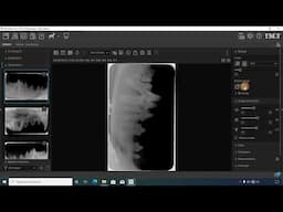 How to Label the Full-Mouth Dental X-Rays using the iM3 Software