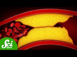 There's a Third Kind of Cholesterol (It's Really Bad)