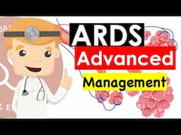 Acute Respiratory Distress Syndrome (ARDS) Advanced - Management | Clinical Medicine