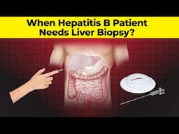 When Hepatitis B Patient Needs Liver Biopsy? | Hepatitis B Treatment | Liver Cirrhosis