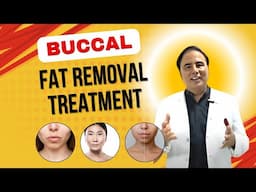 Buccal Fat Removal Surgery Explained in Detail by Dr. Arun Panda, Facial Plastic Surgeon