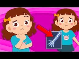 Learn How Broken Bones Heal! | Human Body Songs For Kids | KLT Anatomy