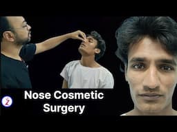 Nose Cosmetic Surgery In Bangalore | Cost Of Nose Cosmetic Surgery In Bangalore | Zenith Clinic