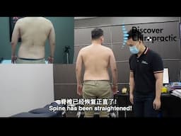 Back Sprain from Badminton HELPED by DC Sean Lee Gonstead Chiropractor