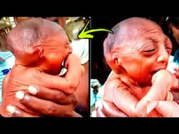 10 Most Unusual & Bizarre Babies That Were Born Different