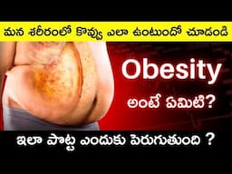 Obesity Explained in Telugu | What is Obesity and Causes & Tips for Weight Loss in Telugu Badi