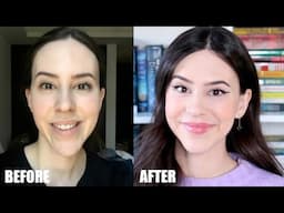 I Got Plastic Surgery in Korea || 18 Months Post Op Double Jaw Surgery