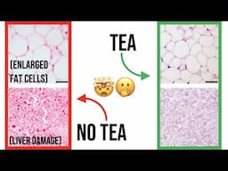 How Black Tea REVERSED a High-Fat Diet 🤯 | Best Tea for Weight Loss?? ☕️🌱😍 #shorts #weightloss #tea