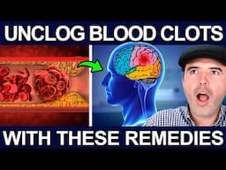 BLOOD CLOT SYMPTOMS AND SOLUTIONS - Foods To Improve Circulation And Prevent Blood Clots