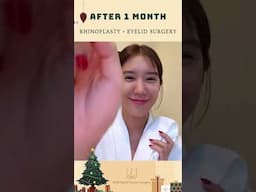 BANOBAGI Real Model: Rhinoplasty + Eyelid surgery!