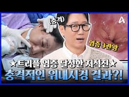 [#스타건강랭킹넘버원] 👑염증 3관왕👑 달성한 지석진! 충격적인 위내시경 결과 대공개💥😱ㅣ스타건강랭킹 넘버원 1회