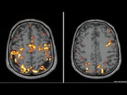 How Sleep Deprivation is Affecting Your BRAIN