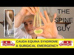 Cauda Equina Syndrome:  A Surgical Emergency