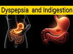 Top  5 Causes of Indigestion and Dyspepsia