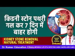 KIDNEY STONE REMOVAL NATURAL TREATMENT//किडनी स्टोन पथरी गल कर 7 दिन में बाहर होगी