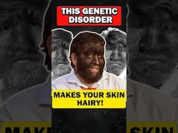 Did you know? Unraveling Hypertrichosis: Excessive Hair Growth Called as werewolf syndrome...