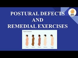 Postural Defects | Remedial Exercises | Physical education notes | B.ed notes