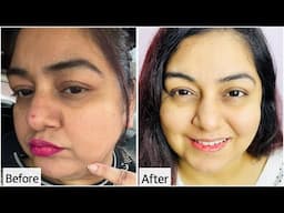 Honest Review | New L'Oréal Paris Glycolic Bright Serum Add Power of Melasyl | JSuper Kaur