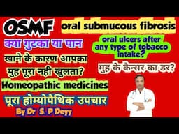 Oral submucous fibrosis | ओरल सुबमुकास फाइब्रोसिस | How to control it by Medicines?