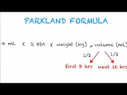 Parkland Formula Made Easy