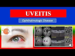 UVEITIS - Definition, types, causes, pathophysiology, symptoms , diagnoses , medicine