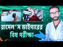 রাসেল'স ভাইপারের বিষ মানুষের শরীরে কি ঘটায়? সাপে কাটলে যেসব ভুল করা যাবে না| Sabbir Ahmed