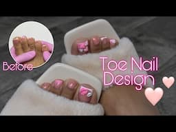 Doing my crusty toes at home! Molding Gel 3D Nail Art | Valentines Day Toe Nails