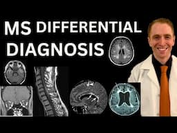 Multiple Sclerosis Differential Diagnosis