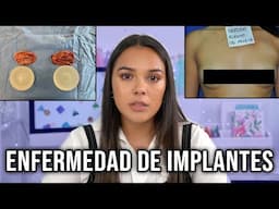 Mi Deformidad- "MIS IMPLANTES ME ESTABAN ENFERMANDO"  | Natalies Outlet