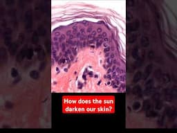 What causes a tan? #biology