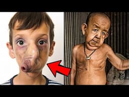 10 Most UNUSUAL People Who Suffer Rare Conditions Born Different