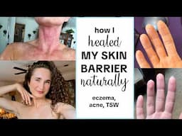 How I Healed My Skin Barrier Overnight // at home, affordable eczema & acne healing skincare