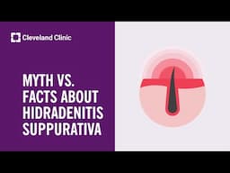 Myth vs. Facts about Hidradenitis Suppurativa